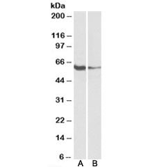 Western blot testing of human tonsil [A] and Daudi [B] lysates with FCRL2 antibody at 1ug/ml. Predic