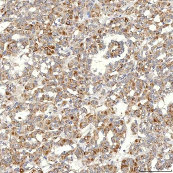 SLC20A1 Antibody / PiT-1