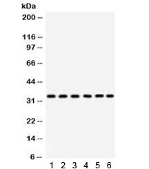 Western blot testing of 1) rat thymus, 2) rat spleen, 3) human MCF7, 4) HeLa, 5) Jurkat, and 6) mous