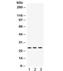 Western blot testing of 1) rat brain, 2) mouse brain and 3) human U87 lysate with PGP 9.5 antibody. 