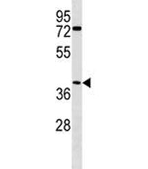 ABHD1 Antibody