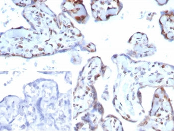 IHC staining of FFPE human placental tissue with p57 antibody (clone KIP2/7639). Strong nuclear stai