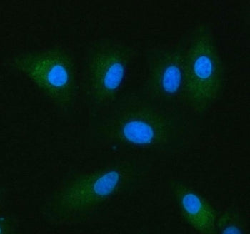 Immunofluorescent staining of FFPE human A549 cells with NADK2 antibody (green) and DAPI nuclear sta