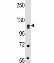 MUSK Antibody, 0.08ml