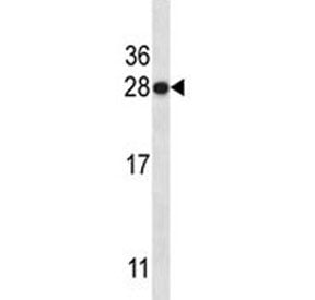 HMGB1 Antibody