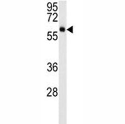 AKT3 Antibody