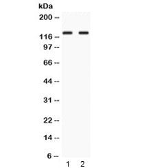 Western blot testing of 1) rat testis and 2) human HepG2 lysate with LRIG3 antibody at 0.5ug/ml. Obs
