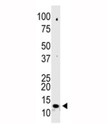 SUMO-2 Antibody