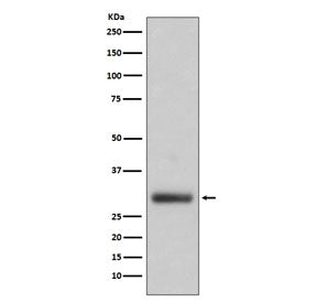 Neutrophil Elastase Antibody