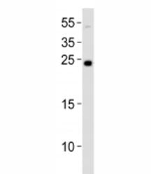 Western blot analysis of lysate from NCCIT cell line using LIN28A antibody at 1:1000. Predicted mole