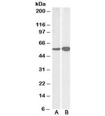 GDH Antibody