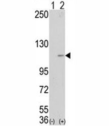 Western blot analysis of LSD1 antibody and 293 cell lysate (2 ug/lane) either nontransfected (Lane 1