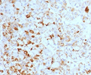 IHC testing of formalin-fixed, paraffin-embedded human pituitary stained with Luteinizing Hormone be