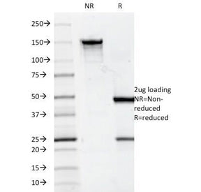 SDS-PAGE Analysis of Purified, BSA-Free CD7 Antibody (clone 124-1D1). Confirmation of Integrity and 