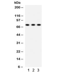 Western blot testing of 1) rat lung, 2) human A549 and 3) HeLa lysate with SP2 antibody. Expected/ob