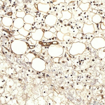 NHERF-2 Antibody / SLC9A3R2