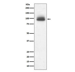 Western blot testing of human A431 cell lysate with NR3C1 antibody. Predicted molecular weight: 91-9