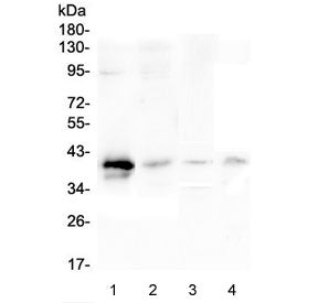 RP2 Antibody / XRP2