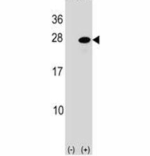 Western blot analysis of ATF3 antibody and 293 cell lysate (2 ug/lane) either nontransfected (Lane 1