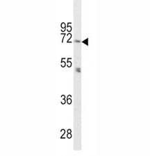 PCSK2 Antibody