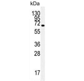 Western blot testing of human HL60 cell lysate with HSPA5 antibody. Predicted molecular weight: ~73 