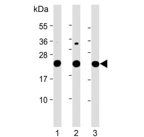 LZIC Antibody