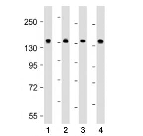 Western blot testing of MYPT1 antibody at 1:4000: Lane 1) human HeLa, 2) human MCF-7, 3) mouse C2C12