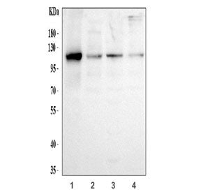 Western blot testing of human 1) U-87 MG, 2) HEL, 3) HepG2 and 4) RT4 cell lysate with Hexokinase II