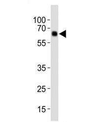 PINK1 Antibody