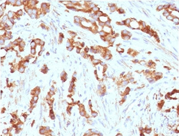 Aurora B Antibody / AURKB