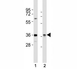 PAX4 Antibody