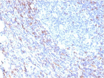 IHC staining of FFPE human tonsil with recombinant ZAP70 antibody. HIER: boil tissue sections in pH 