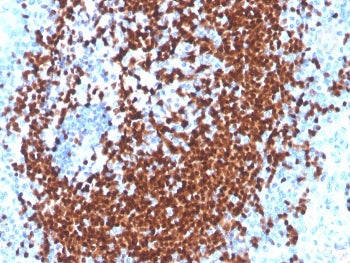 IHC staining of FFPE human tonsil tissue with recombinant PAX5 antibody (clone PAX5/3977R). HIER: bo