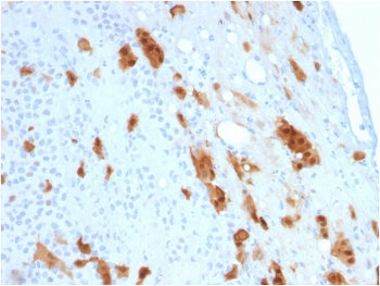 Calbindin 2 Antibody / CALB2 / Calretinin