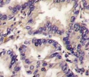 VEGFC Antibody