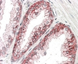 Alpha-Catenin Antibody