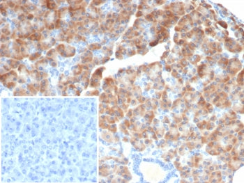 IHC staining of FFPE human pancreas tissue with IL-6 antibody (clone IL6/4642) at 2ug/ml. Inset: PBS