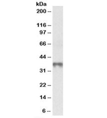 MAT2B Antibody