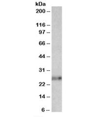 Ephrin A1 Antibody