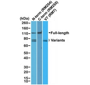 Androgen Receptor Antibody / C-terminus