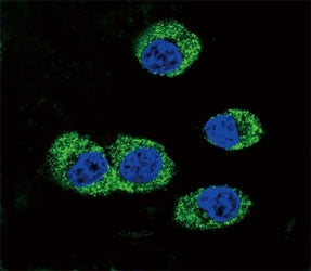 RAGE Antibody