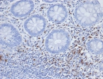S100A4 Antibody / FSP1