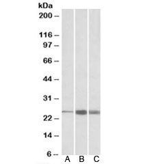 TNNI2 Antibody