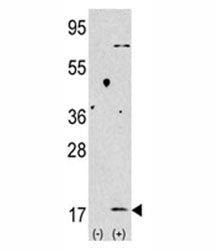 LC3B Antibody (MAP1LC3B)