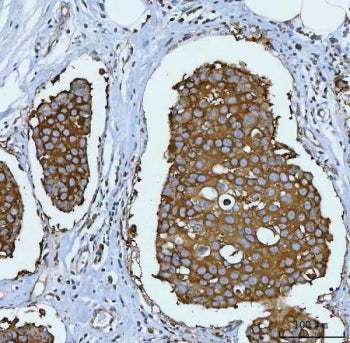 HSP90 alpha/beta Antibody