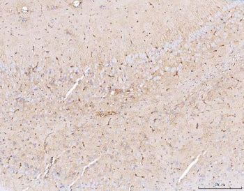IHC staining of FFPE mouse brain tissue with Aquaporin 4 antibody. HIER: boil tissue sections in pH8