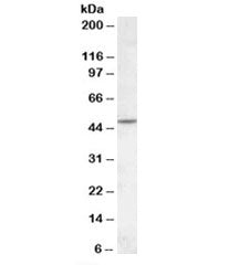 Western blot testing of human cerebellum lysate with CHRNB2 antibody at 1ug/ml. Predicted molecular 