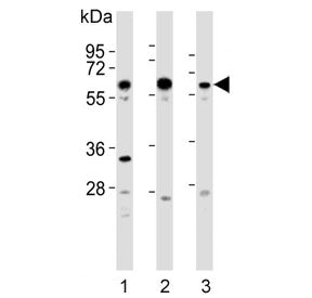 GRK5 Antibody