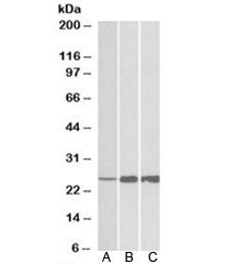 TNNI2 Antibody