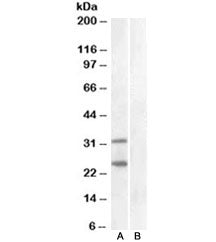 SOCS1 Antibody
